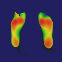 Orthotic Measurement